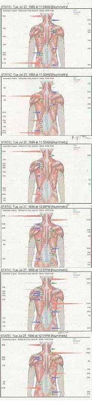 strain chart